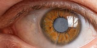 Avances en el tratamiento del glaucoma